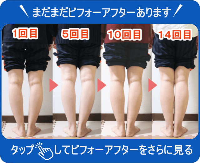 まだまだビフォーアフターあります　タップしてビフォーアフターをさらに見る