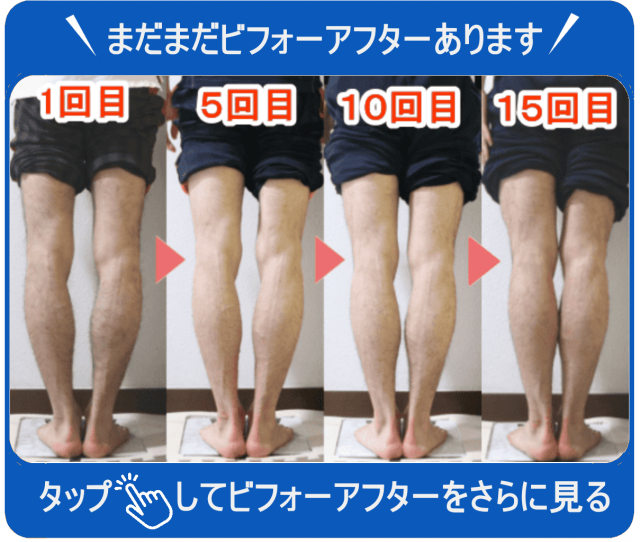 まだまだビフォーアフターあります　タップしてビフォーアフターを見る