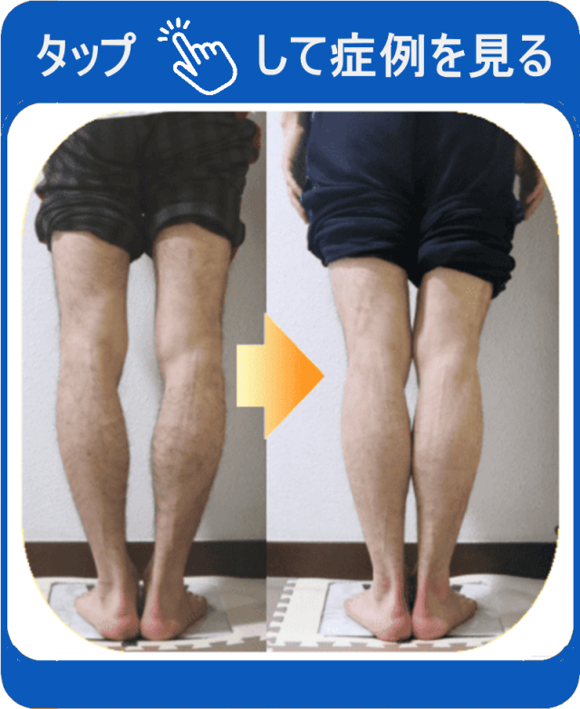 タップして症例を見る