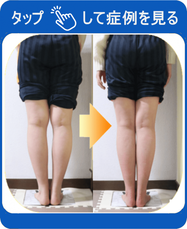 タップして症例を見る