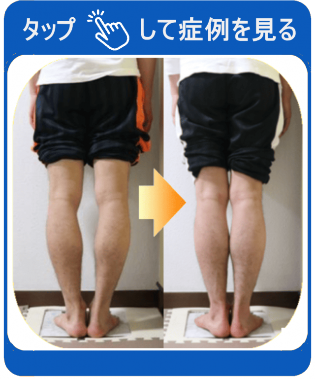 タップして症例を見る